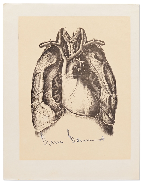 Dr. Christiaan Barnard Signed Print of a Human Heart -- Barnard Performed the First Human Heart Transplant Operation -- With PSA/DNA COA